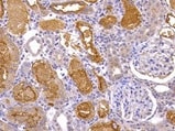 Human TIM‑1/KIM‑1/HAVCR Antibody MAB1750
