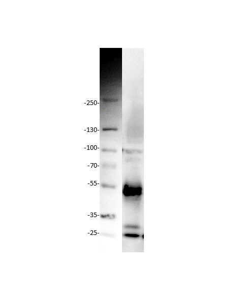 Human TIM‑1/KIM‑1/HAVCR Antibody MAB1750