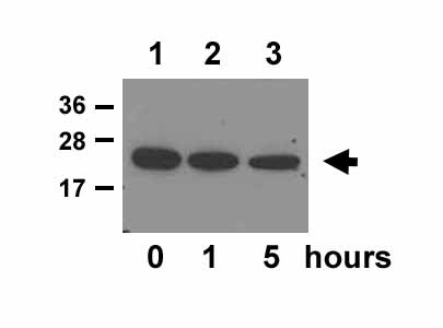 Human Lipocalin‑2/NGAL Antibody MAB1757
