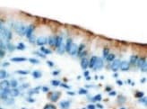 Human Lipocalin‑2/NGAL Antibody MAB1757