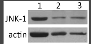 Human/Mouse/Rat JNK1 Antibody MAB17761