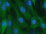 Human/Mouse/Rat JNK1 Antibody MAB17761