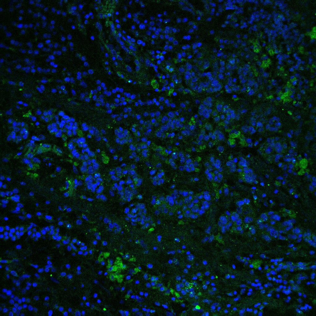 Human CD11c Antibody MAB1777
