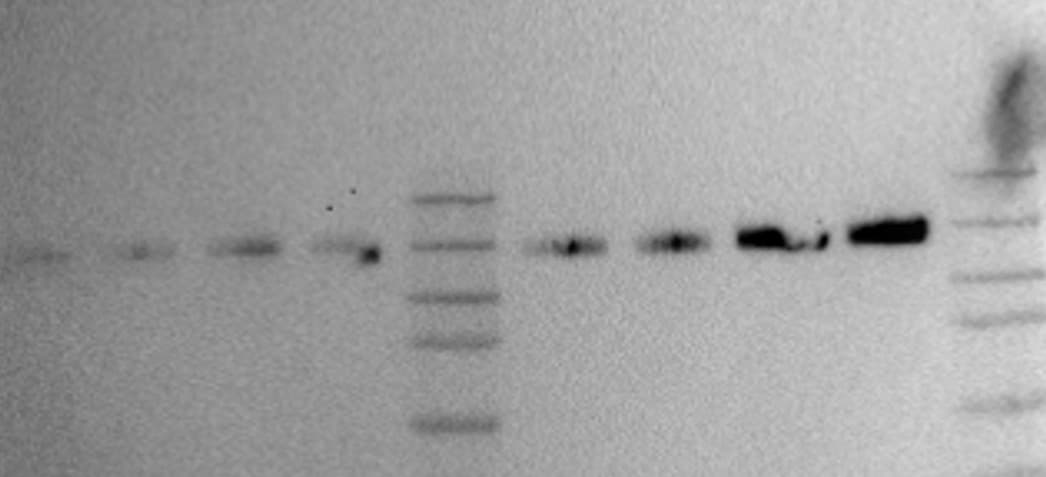 Human Integrin  beta 1/CD29 Antibody MAB17781