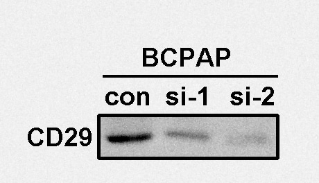Human Integrin  beta 1/CD29 Antibody MAB17781