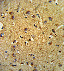 Human LOX‑1/OLR1 Antibody MAB17981