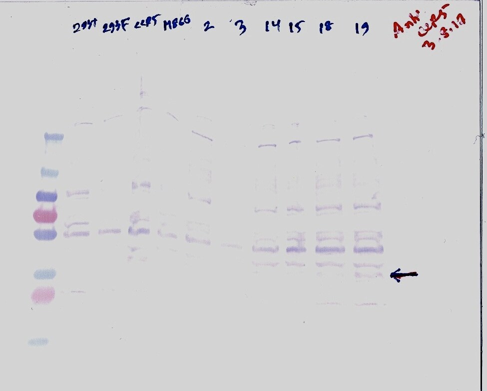 Human CCR5 Antibody MAB1801