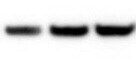 Mouse TIM‑1/KIM‑1/HAVCR Antibody MAB1817
