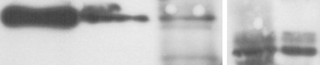 Mouse Klotho Antibody MAB1819