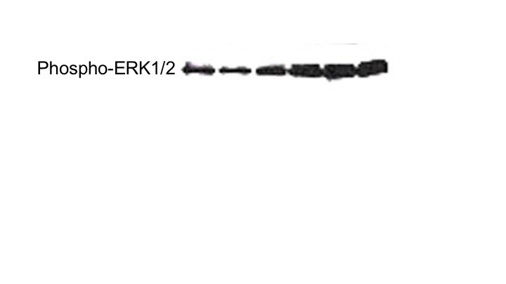 Human/Mouse Phospho-ERK1 (ERK1 T202/Y204, ERK2 T185/Y187) Antibody MAB18251