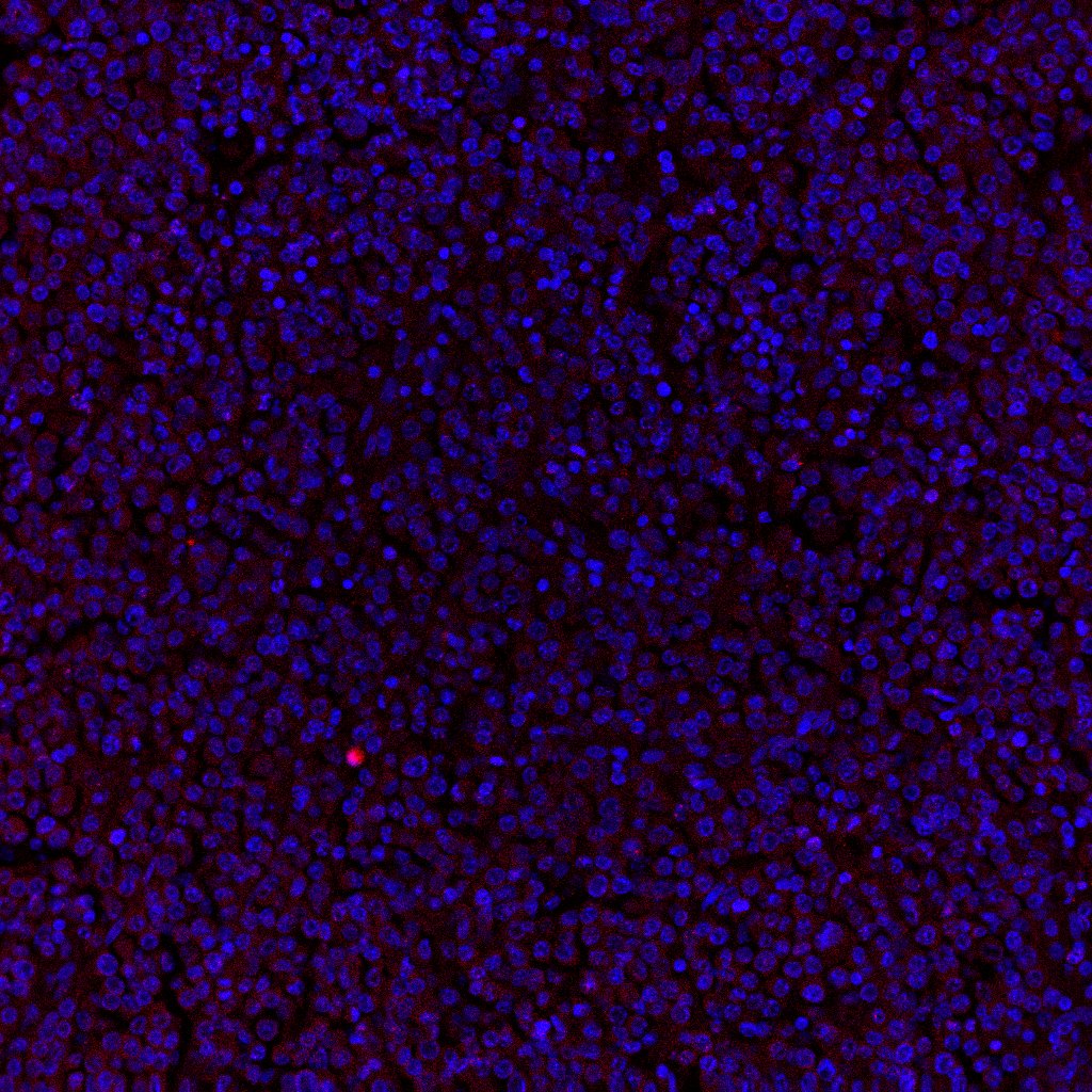 Human CCR5 Antibody MAB182