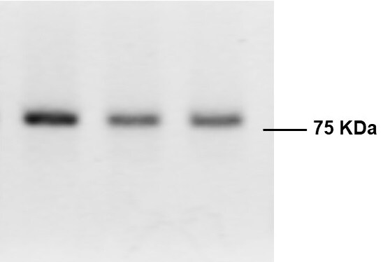 Mouse IL-6R alpha Antibody MAB18301