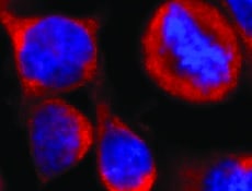 Mouse IL-6R alpha Antibody MAB18301