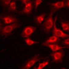 TGF-beta 1, 2, 3 Antibody MAB1835