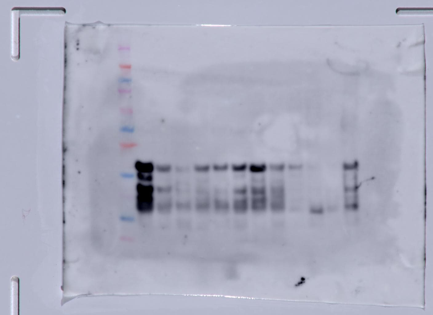TGF-beta 1, 2, 3 Antibody MAB1835
