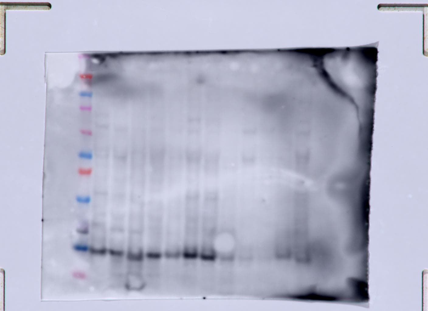 TGF-beta 1, 2, 3 Antibody MAB1835
