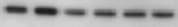 TGF-beta 1, 2, 3 Antibody MAB1835