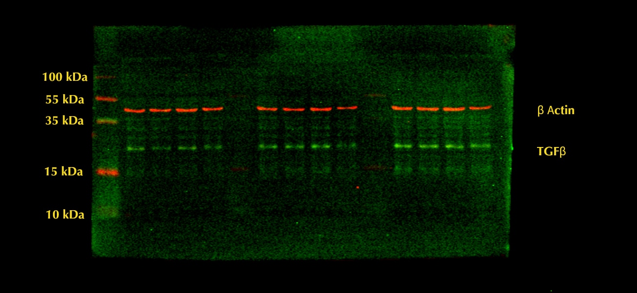 TGF-beta 1, 2, 3 Antibody MAB1835