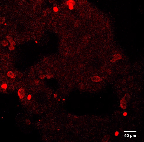 Human E‑Cadherin Antibody MAB18381