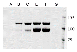 Human E‑Cadherin Antibody MAB18381