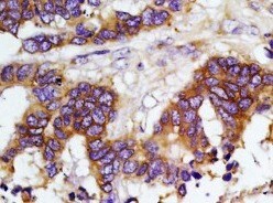 Human/Mouse Cadherin Pan Specific Antibody MAB18385