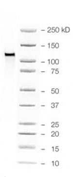 Human E‑Cadherin Antibody MAB1838