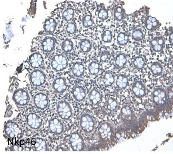Human NKp46/NCR1 Antibody MAB1850