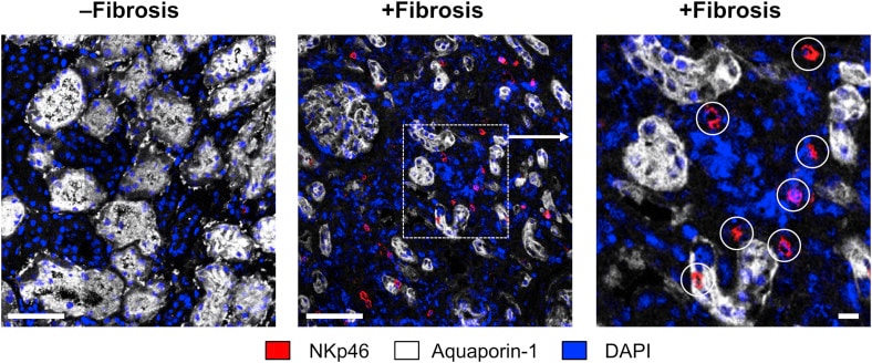 Human NKp46/NCR1 Antibody MAB1850