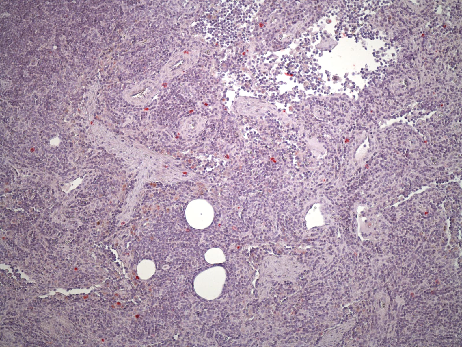 Human NKp46/NCR1 Antibody MAB1850