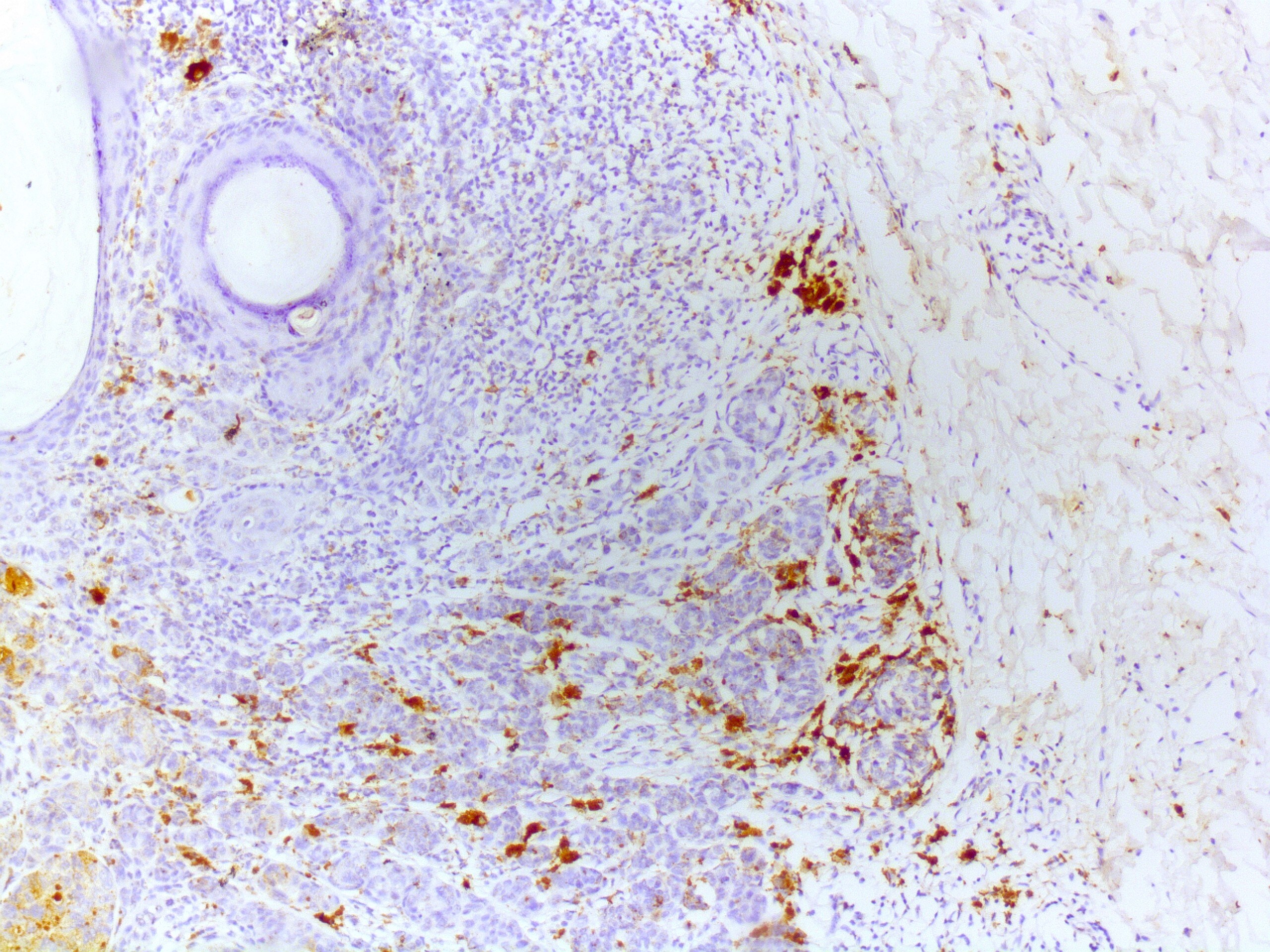 Human NKp46/NCR1 Antibody MAB1850