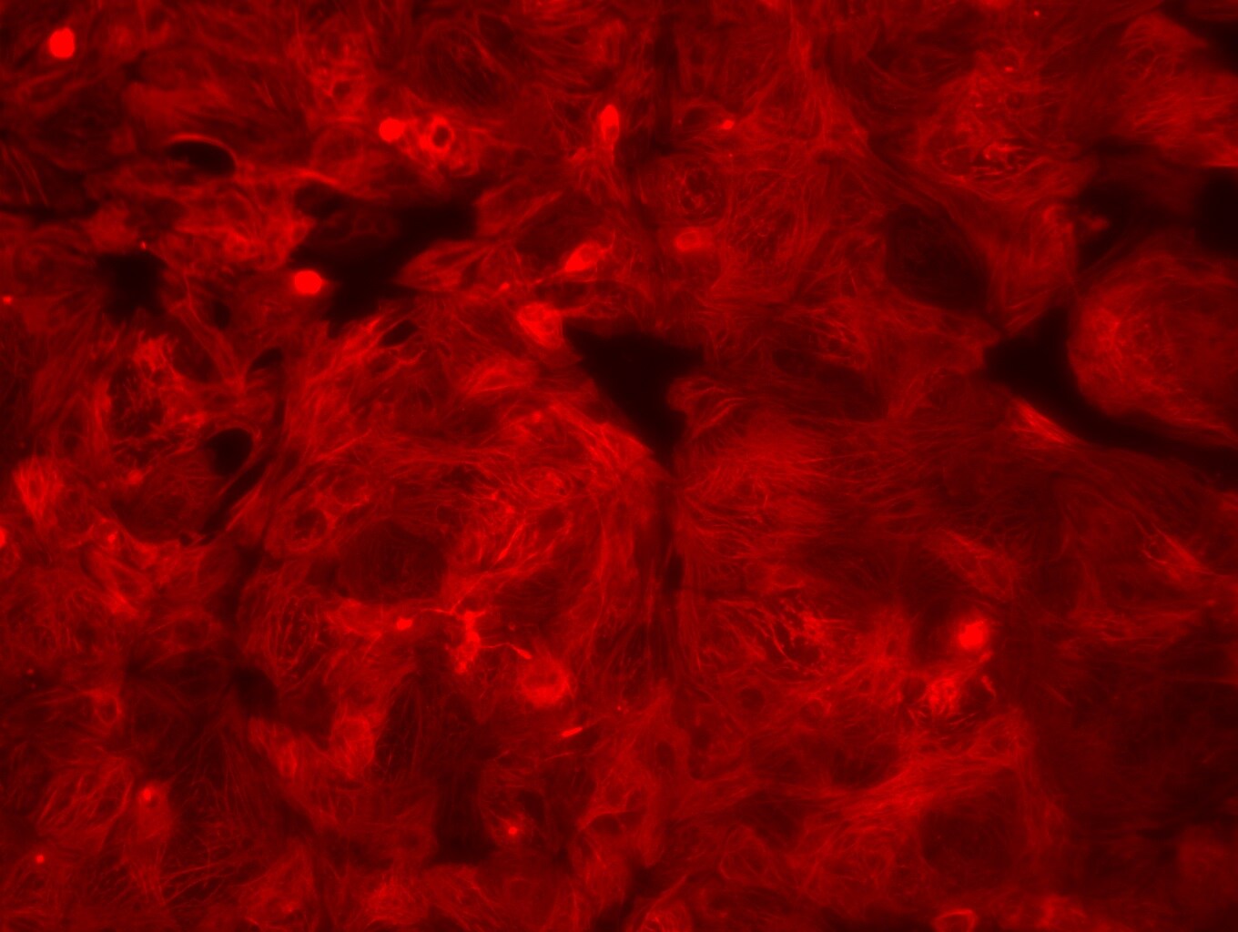 Human Troponin T (Cardiac) Antibody MAB1874