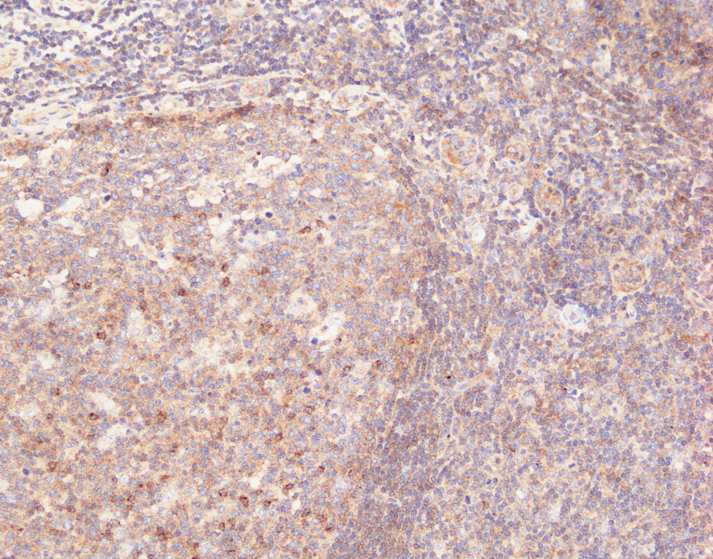 Human CXCR5 Antibody MAB190