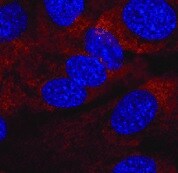 Human CXCR5 Antibody MAB190