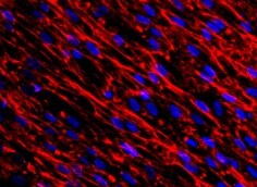 Human Fibronectin Antibody MAB19181