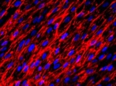 Human Fibronectin Antibody MAB1918