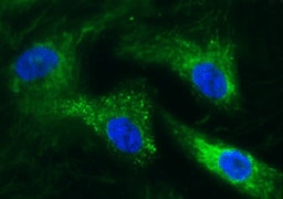Human Fibronectin Antibody MAB1918