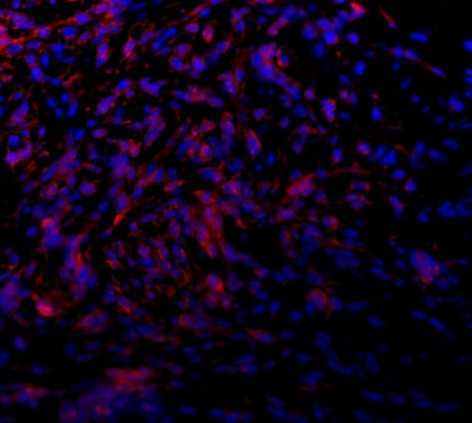 Human MRP1 Antibody MAB19291