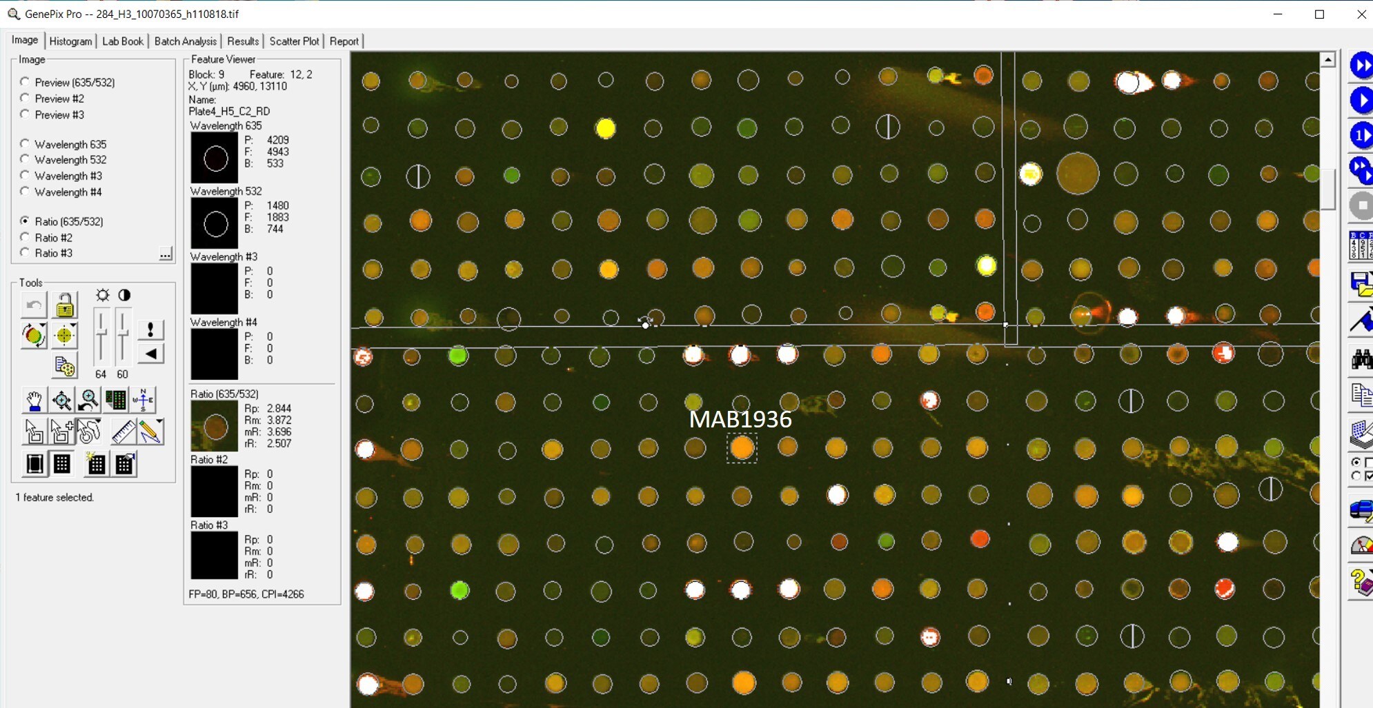 Human Complement Component C2b Antibody MAB1936