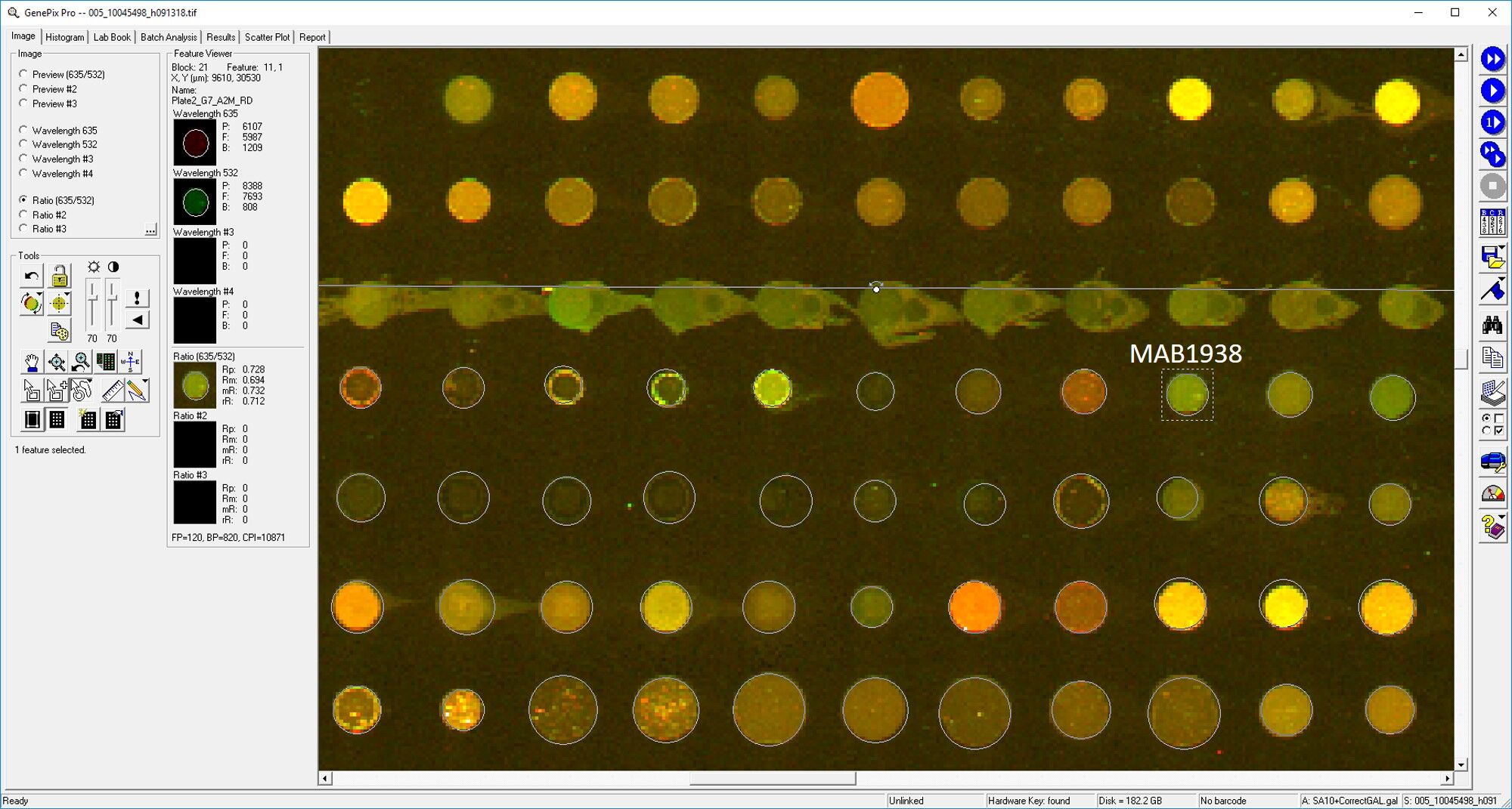 Human  alpha 2-Macroglobulin Antibody MAB1938