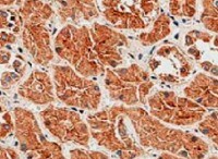 Human LRIG2 Antibody MAB19411