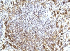 Human CCR7 Antibody MAB197