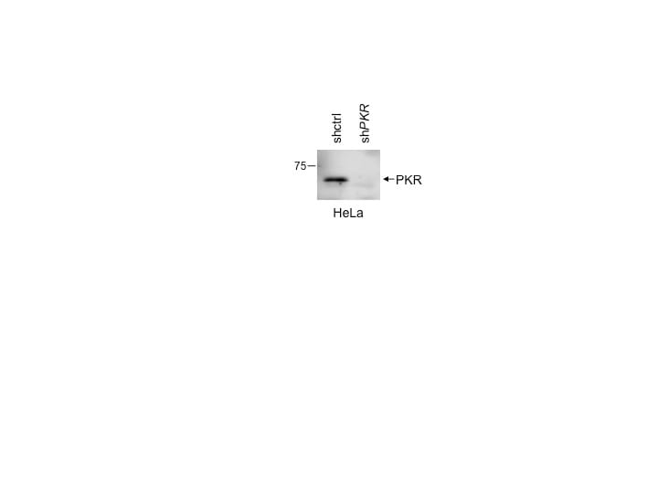 Human PKR Antibody MAB1980