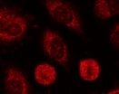 Human PKR Antibody MAB1980