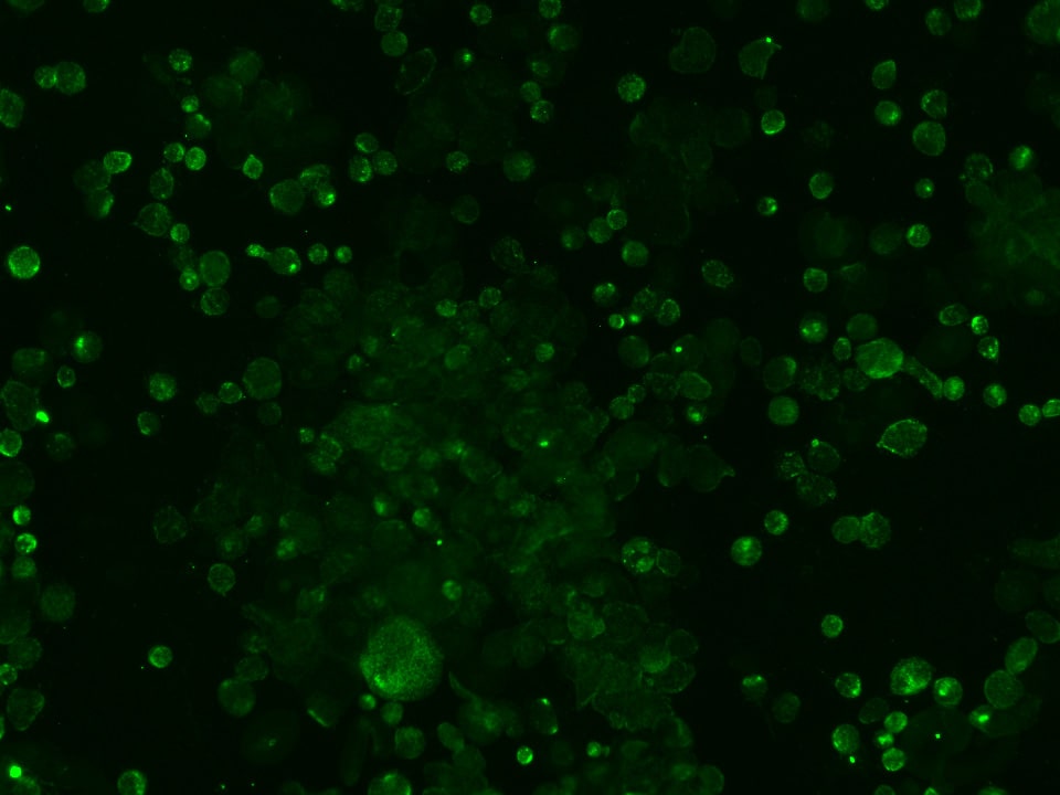 Human/Mouse Frizzled‑7 Antibody MAB1981