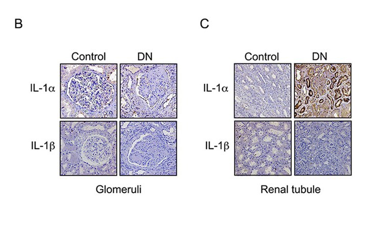 Human IL‑1 alpha /IL‑1F1 Antibody MAB200