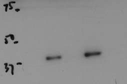 Human/Mouse/Rat SOX2 Antibody MAB2018