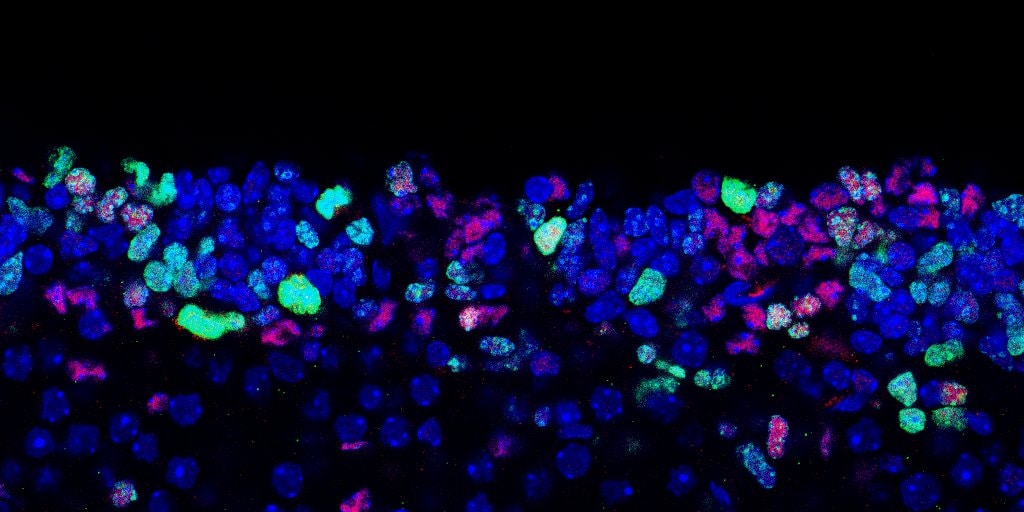 Human/Mouse/Rat SOX2 Antibody MAB2018