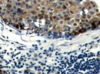 Human IL‑2 Antibody MAB2022