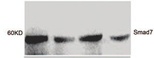 Human/Mouse/Rat Smad7 Antibody MAB2029