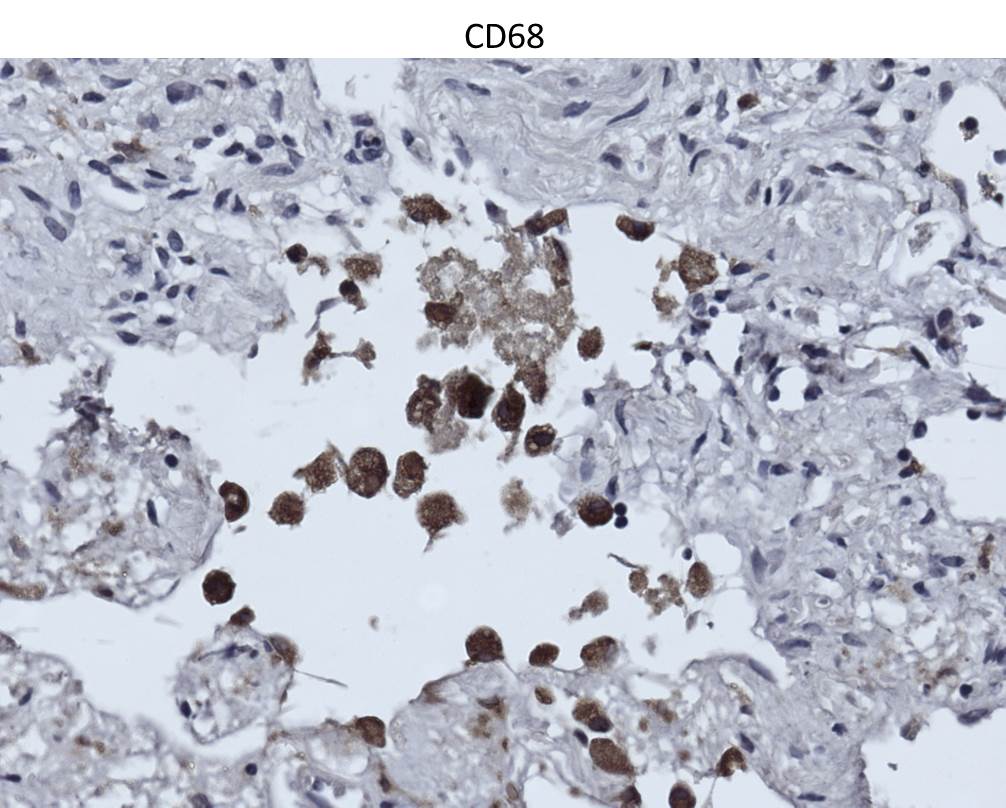 Human CD68/SR‑D1 Antibody MAB20401